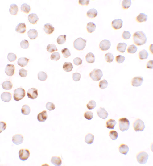 8 - TIAF Antibody ASC11645