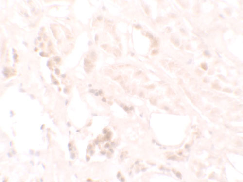 2 - KANK3 Antibody ASC11648