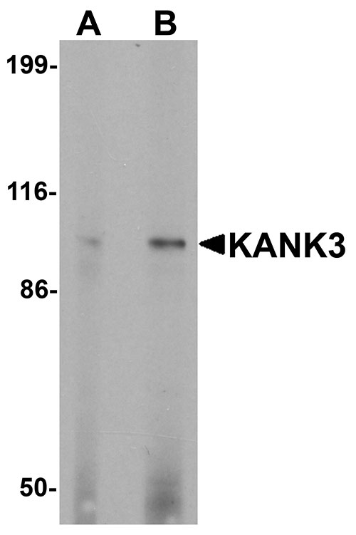 1 - KANK3 Antibody ASC11648