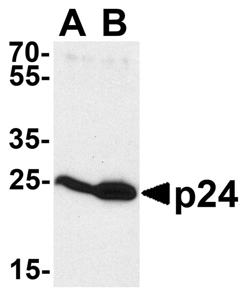 1 - HIV-1 p24 Antibody ASC11649
