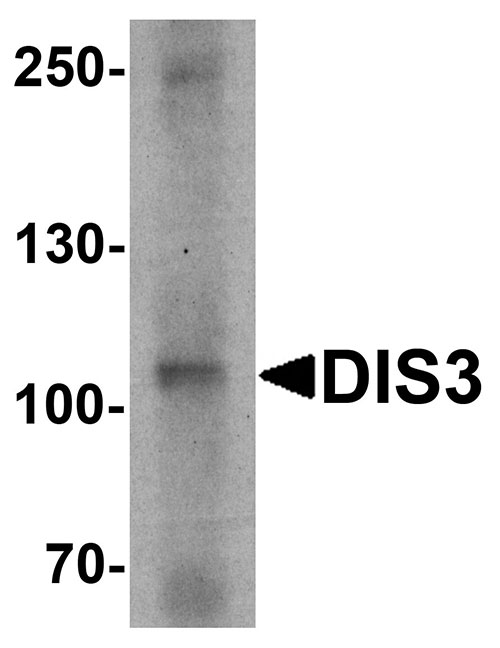 1 - DIS3 Antibody ASC11656