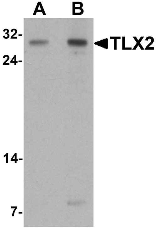 1 - TLX2 Antibody ASC11662