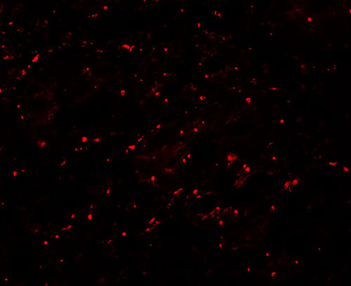 3 - LPIN1 Antibody ASC11671