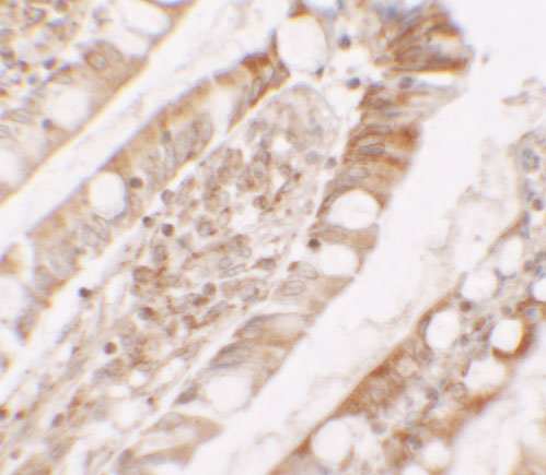 2 - LPIN1 Antibody ASC11671