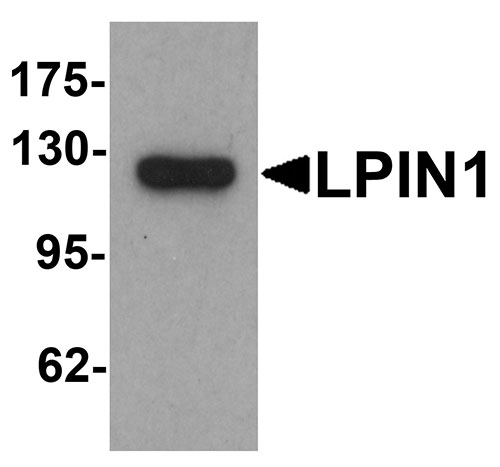 1 - LPIN1 Antibody ASC11671