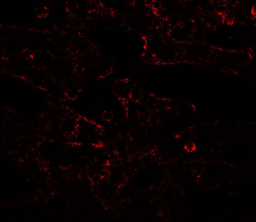 3 - IL-17RA Antibody ASC11676