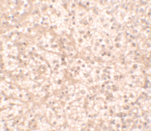 2 - IL-17RA Antibody ASC11676