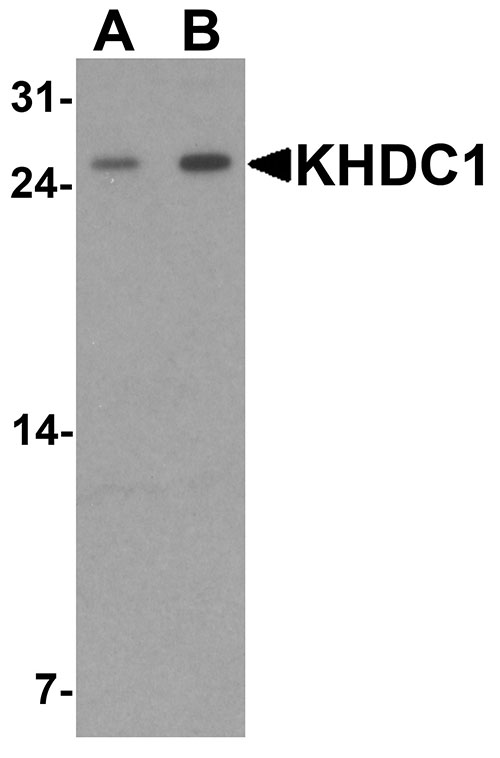 1 - KHDC1 Antibody ASC11678