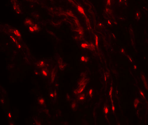 3 - WFDC2 Antibody  ASC11692