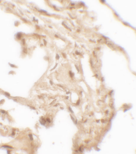 2 - WFDC2 Antibody  ASC11692