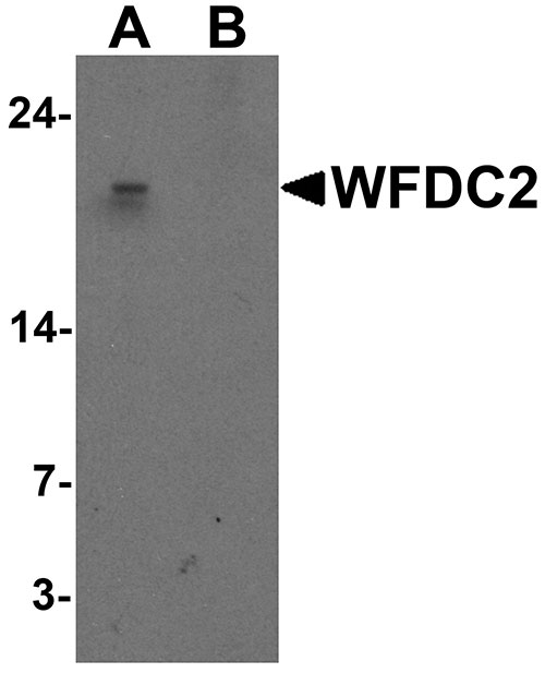 1 - WFDC2 Antibody  ASC11692