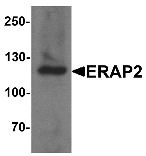 1 - ERAP2 Antibody  ASC11695