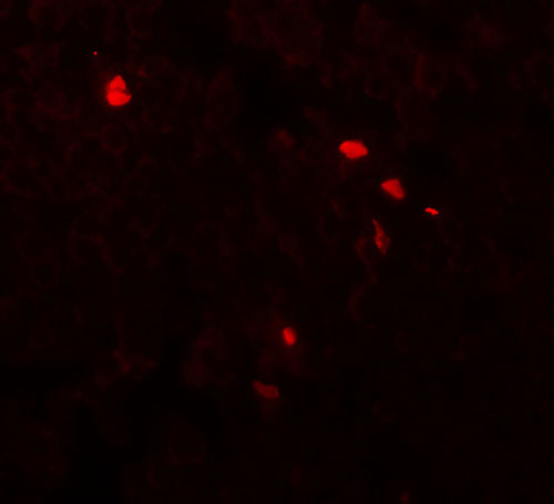 3 - TMEM107 Antibody  ASC11701