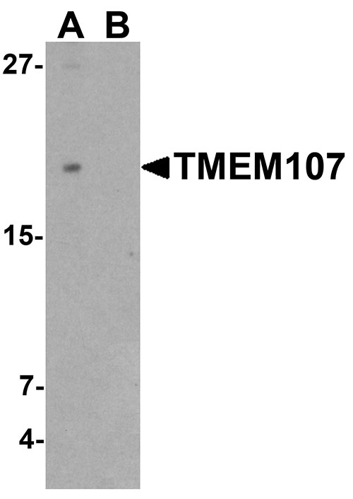 1 - TMEM107 Antibody  ASC11701