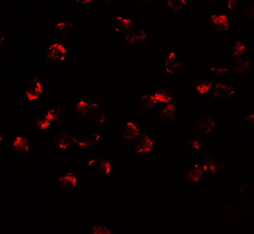 3 - PHF14 Antibody  ASC11702