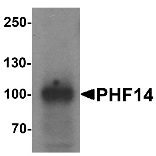 1 - PHF14 Antibody  ASC11702
