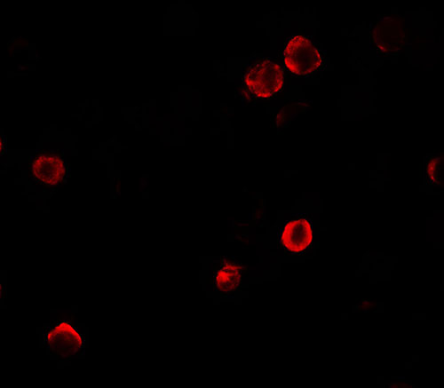 3 - SOGA1 Antibody  ASC11703