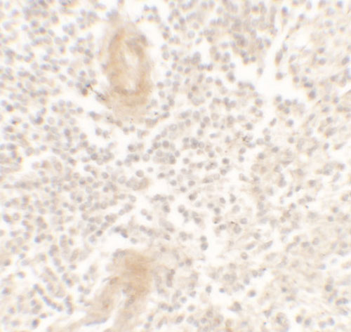 2 - IL-1F10 Antibody ASC11709