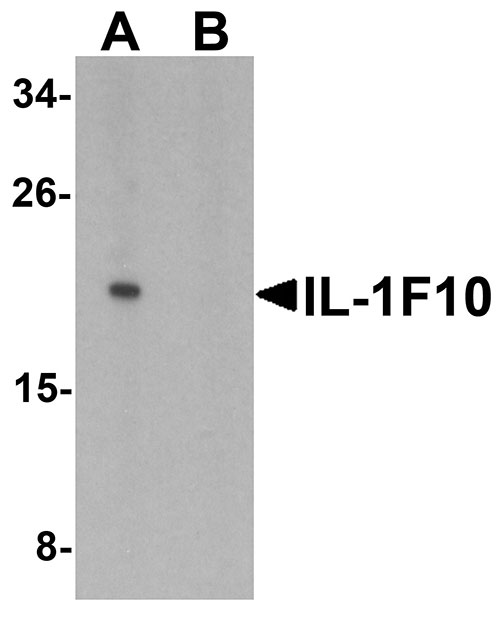 1 - IL-1F10 Antibody ASC11709