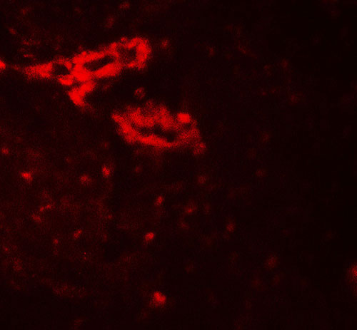 3 - IL-36G Antibody ASC11712