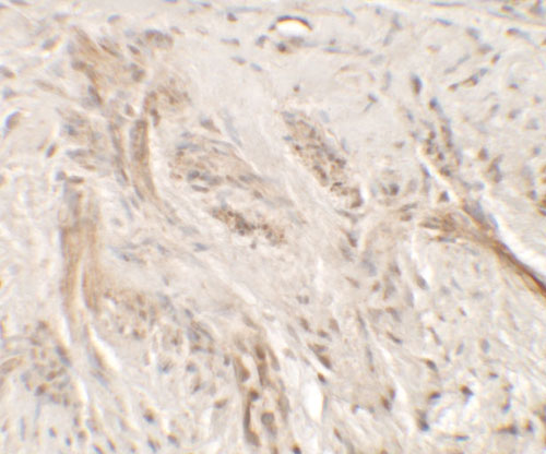 2 - IL-36G Antibody ASC11712