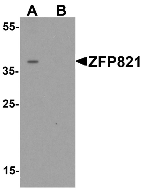 1 - ZNF821 Antibody ASC11719