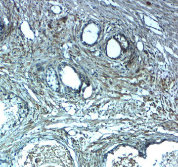 2 - LRRC26 Antibody ASC11720