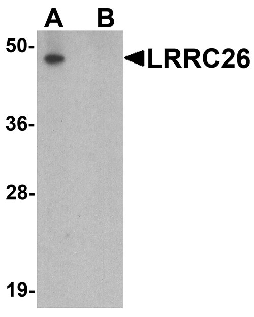 1 - LRRC26 Antibody ASC11720