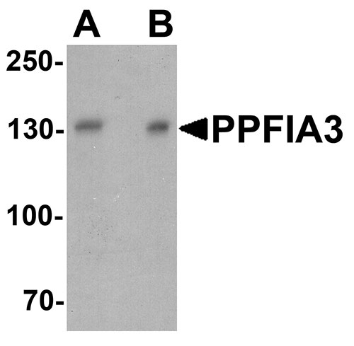 1 - PPFIA3 Antibody ASC11723