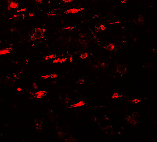 3 - ULK4 Antibody ASC11730