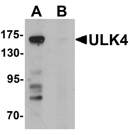 1 - ULK4 Antibody ASC11730