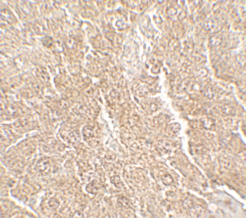 2 - RPSA Antibody ASC11736