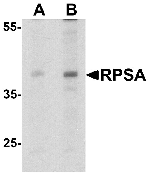 1 - RPSA Antibody ASC11736