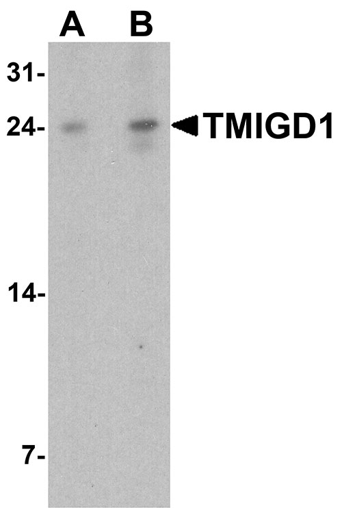 1 - TMIGD1 Antibody ASC11739