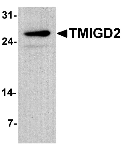 1 - TMIGD2 Antibody ASC11740