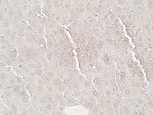 2 - Betatrophin Antibody ASC11741