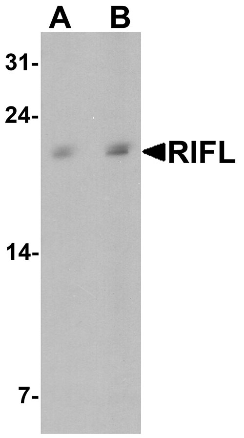 1 - Betatrophin Antibody ASC11741
