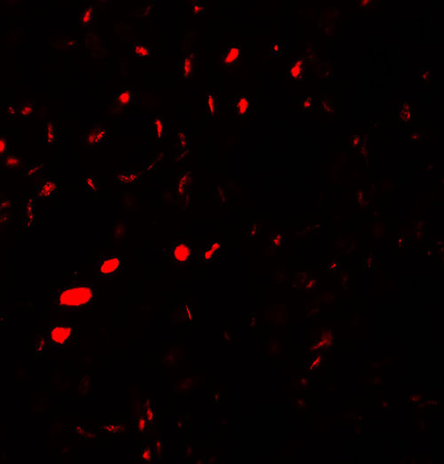 3 - AQP2 Antibody ASC11742