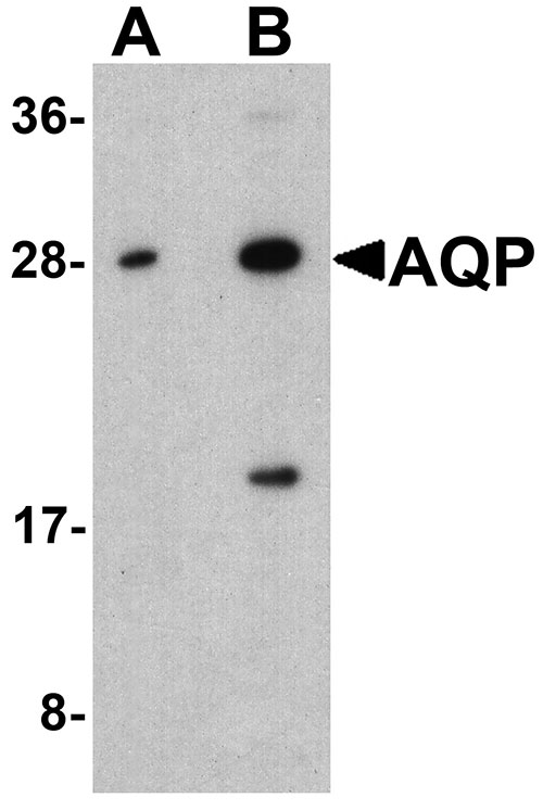 1 - AQP2 Antibody ASC11742