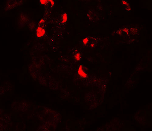 3 - GLIPR1L1 Antibody ASC11744