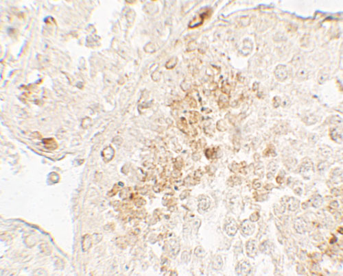 2 - GLIPR1L1 Antibody ASC11744