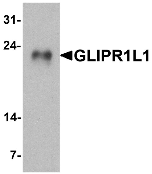 1 - GLIPR1L1 Antibody ASC11744