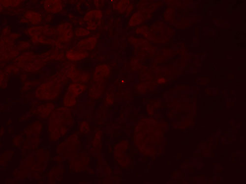 3 - GLIPR1L2 Antibody ASC11745