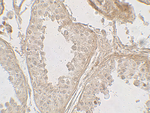 2 - GLIPR1L2 Antibody ASC11745