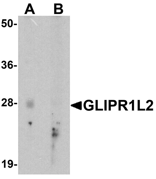 1 - GLIPR1L2 Antibody ASC11745