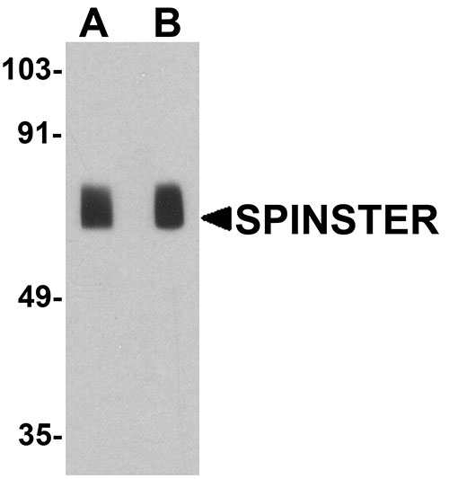 1 - SPINSTER Antibody ASC11751