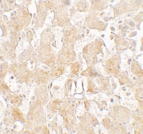 2 - UCP1 Antibody ASC11762