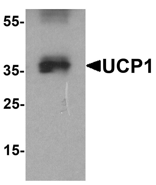 1 - UCP1 Antibody ASC11762