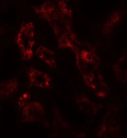 3 - ARF6 Antibody ASC11763