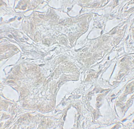 2 - ARF6 Antibody ASC11763